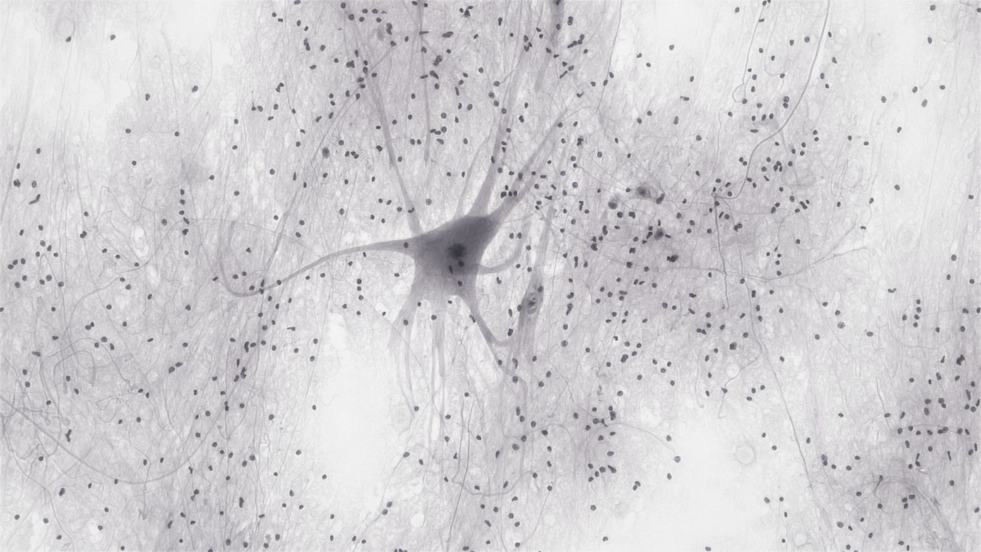 Microscopic image of a nerve cell with fine branching extensions